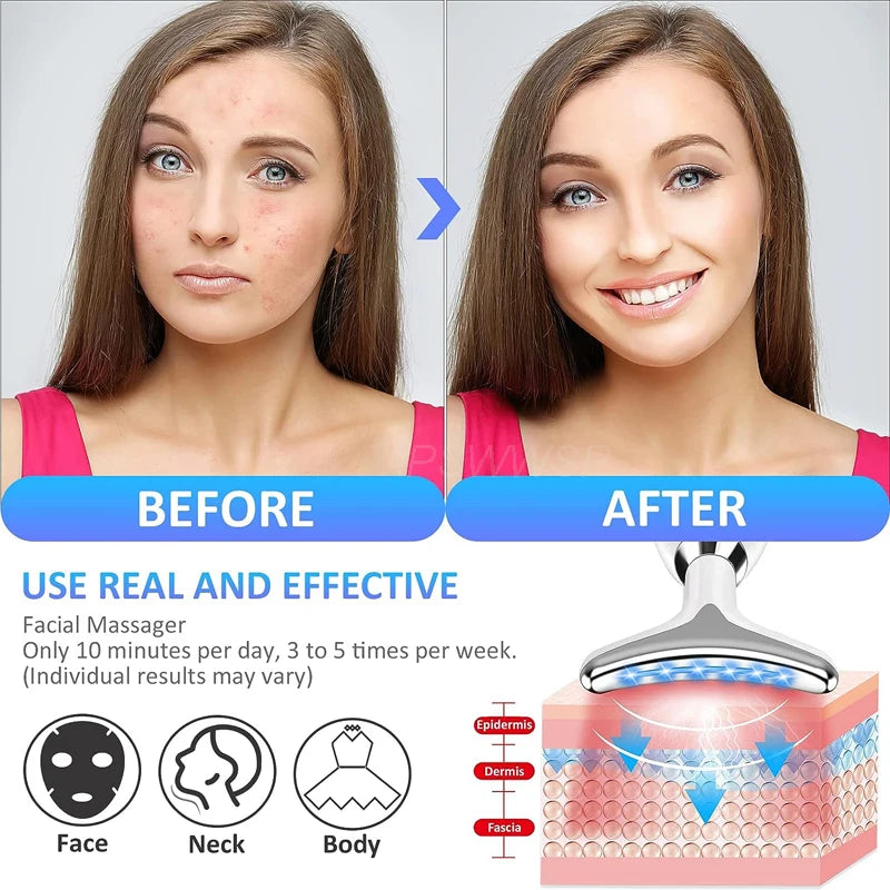 Skin Tightening & Beauty Massager
